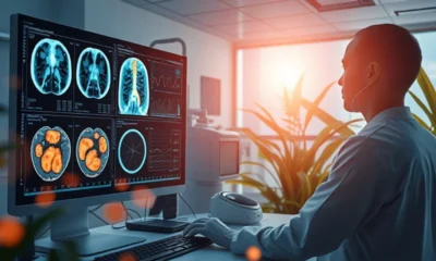 Doctor check chest infection using AI